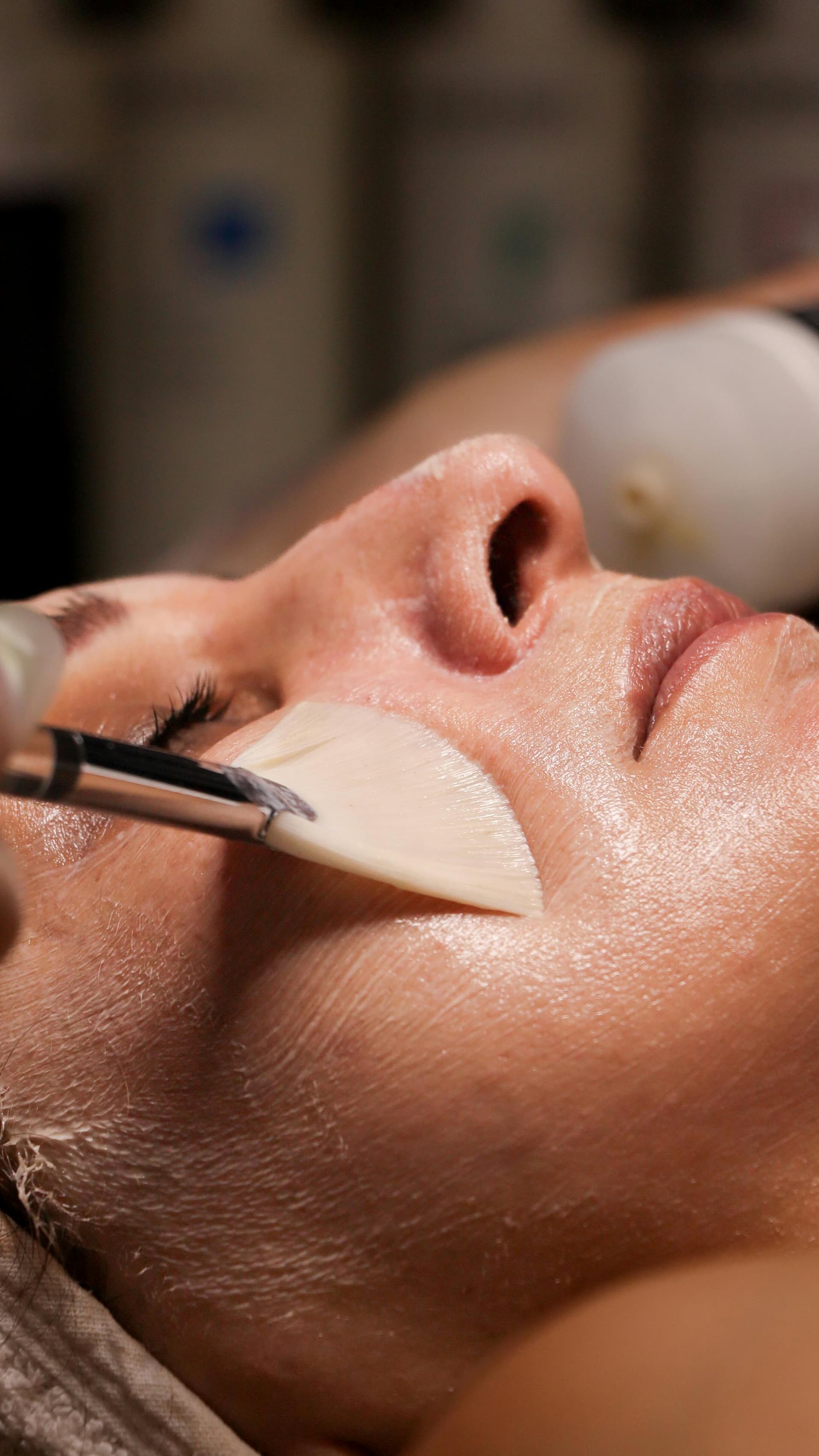 Peeling Químico Facial